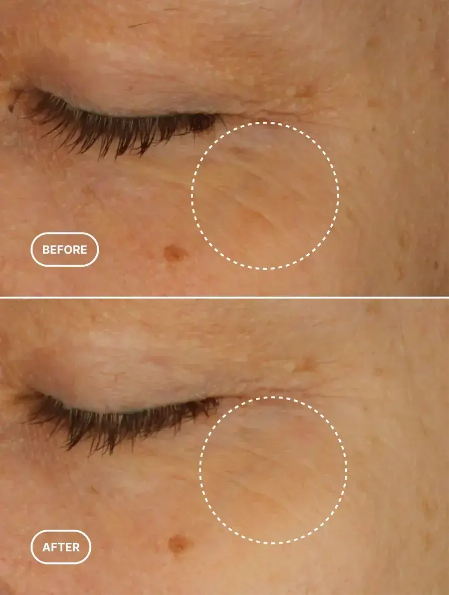 Sérum contour des yeux alternatif au rétinol Selfnamed